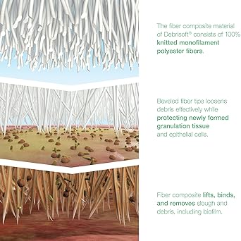 Load image into Gallery viewer, Lohmann & Rauscher Debrisoft® Pad, Box of 5