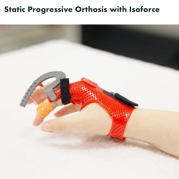 Load image into Gallery viewer, North Coast Medical Isoforce Outrigger System