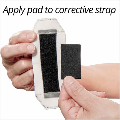 Load image into Gallery viewer, 3pp® Elbow POP™ Splint