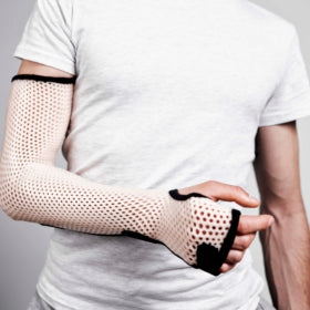 Load image into Gallery viewer, Orfit Classic, Soft