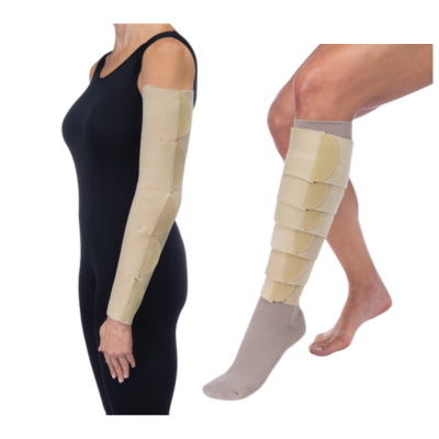 Edema
