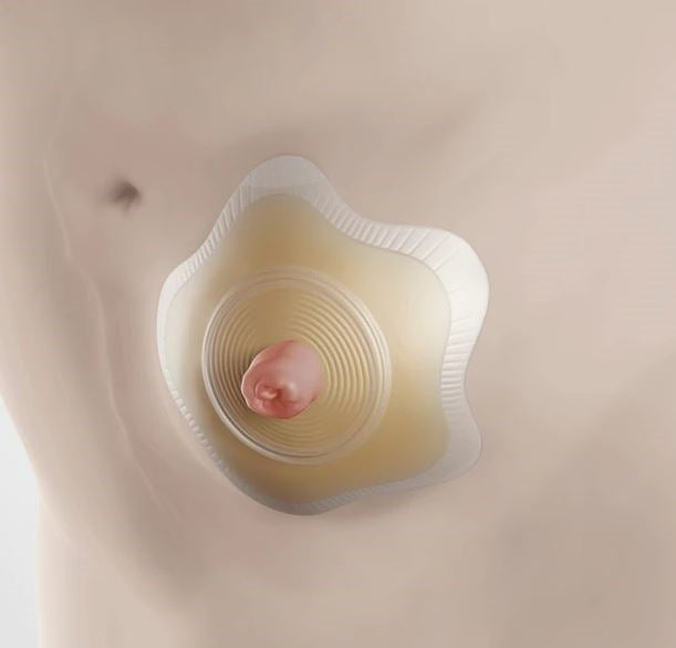 Load image into Gallery viewer, Coloplast SenSura® Mio Convex Flip 2-piece Click