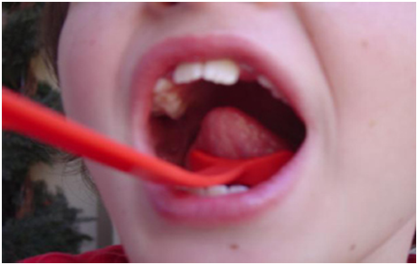 Load image into Gallery viewer, Tongue LifteR