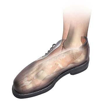 Hapad Comf-Orthotic Extra Cushioning Replacement Insoles