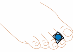 Load image into Gallery viewer, Silipos Silopad Digital Pads