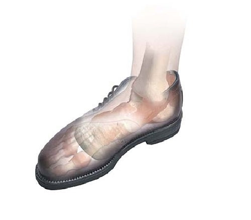 Load image into Gallery viewer, Hapad Heel Pads
