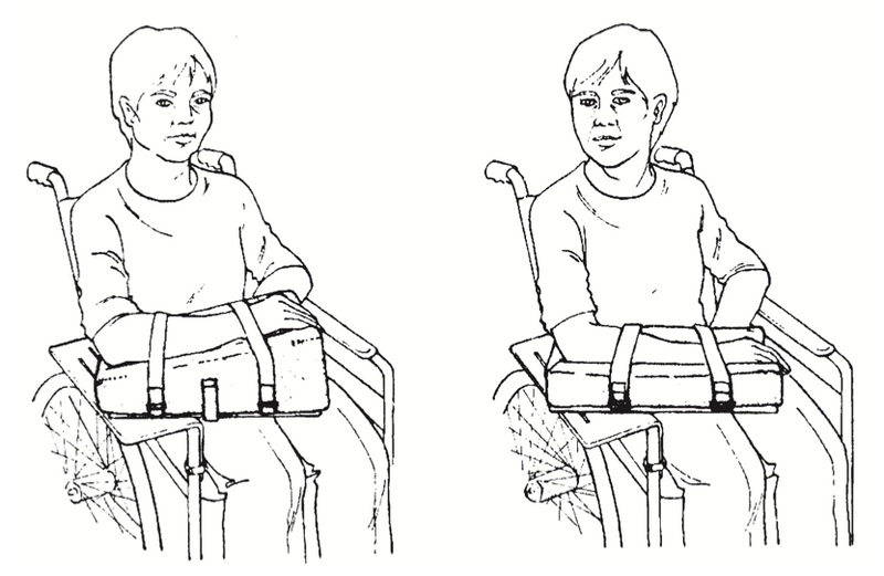 Load image into Gallery viewer, SkiL-Care Mobile Arm Support