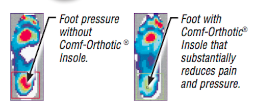 Hapad® Comf-Orthotic® 3/4 Length Insoles