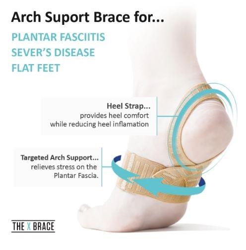 Load image into Gallery viewer, Tuli's® The X Brace®