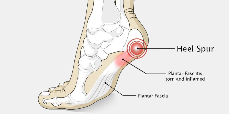 Load image into Gallery viewer, Hapad Heel Pads