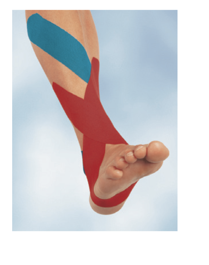 Load image into Gallery viewer, BSN Medical Leukotape K - Kinesiology Therapeutic Adhesive Tape