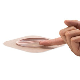 Load image into Gallery viewer, Hollister New Image Soft Convex CeraPlus Skin Barrier - Tape