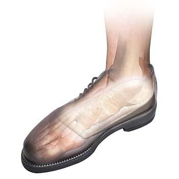 Hapad 3/4 Length Heel Lifts
