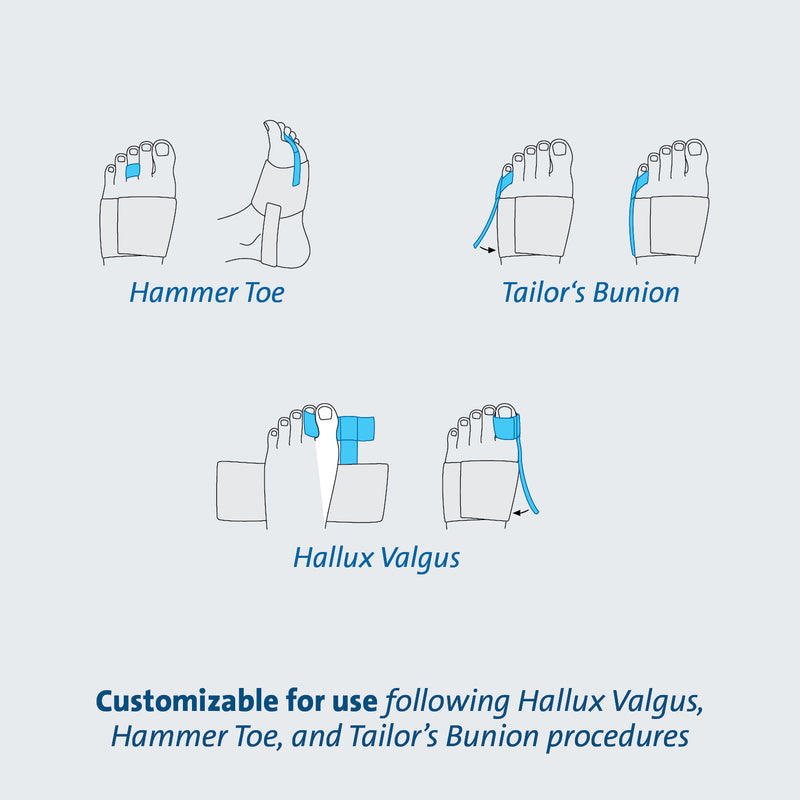 Load image into Gallery viewer, Darco Toe Alignment Splint