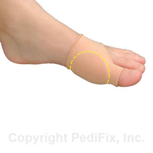 Load image into Gallery viewer, Pedifix Visco-GEL Bunion Relief Sleeve