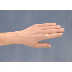 Oval-8® Finger Splints