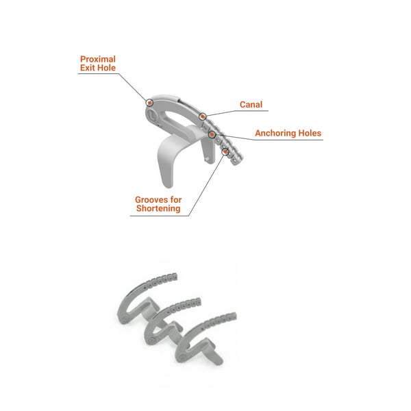 North Coast Medical Isoforce Outrigger System